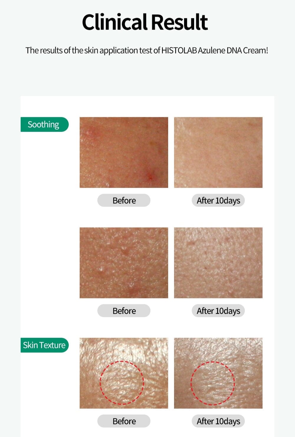 Azulene DNA cream Homecare HistoLab Medical Skincare 