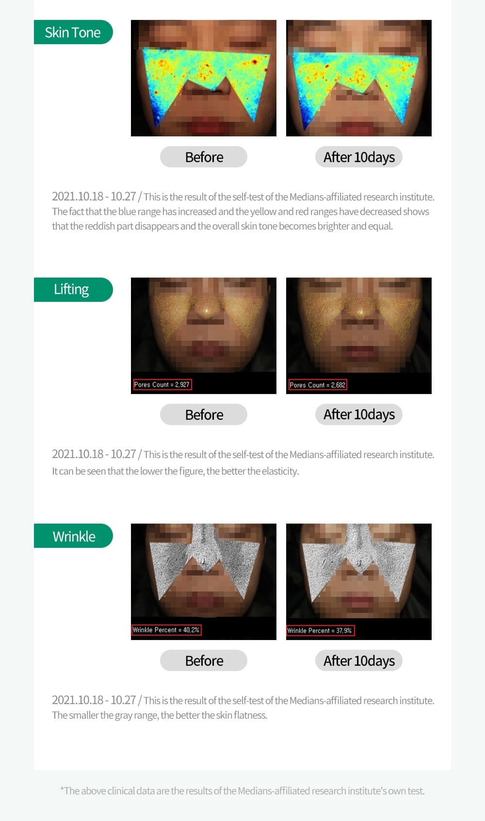 Azulene DNA cream Homecare HistoLab Medical Skincare 